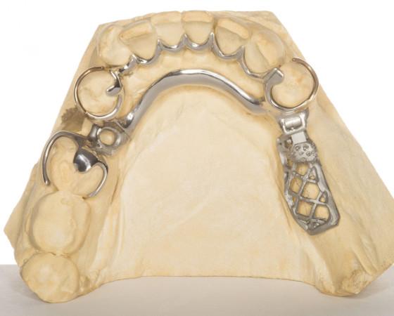Etxedental Laboratorio Prot sico Dental En Donostia San Sebasti n Etxedental Laboratorio Prot sico Dental En Donostia San Sebasti n